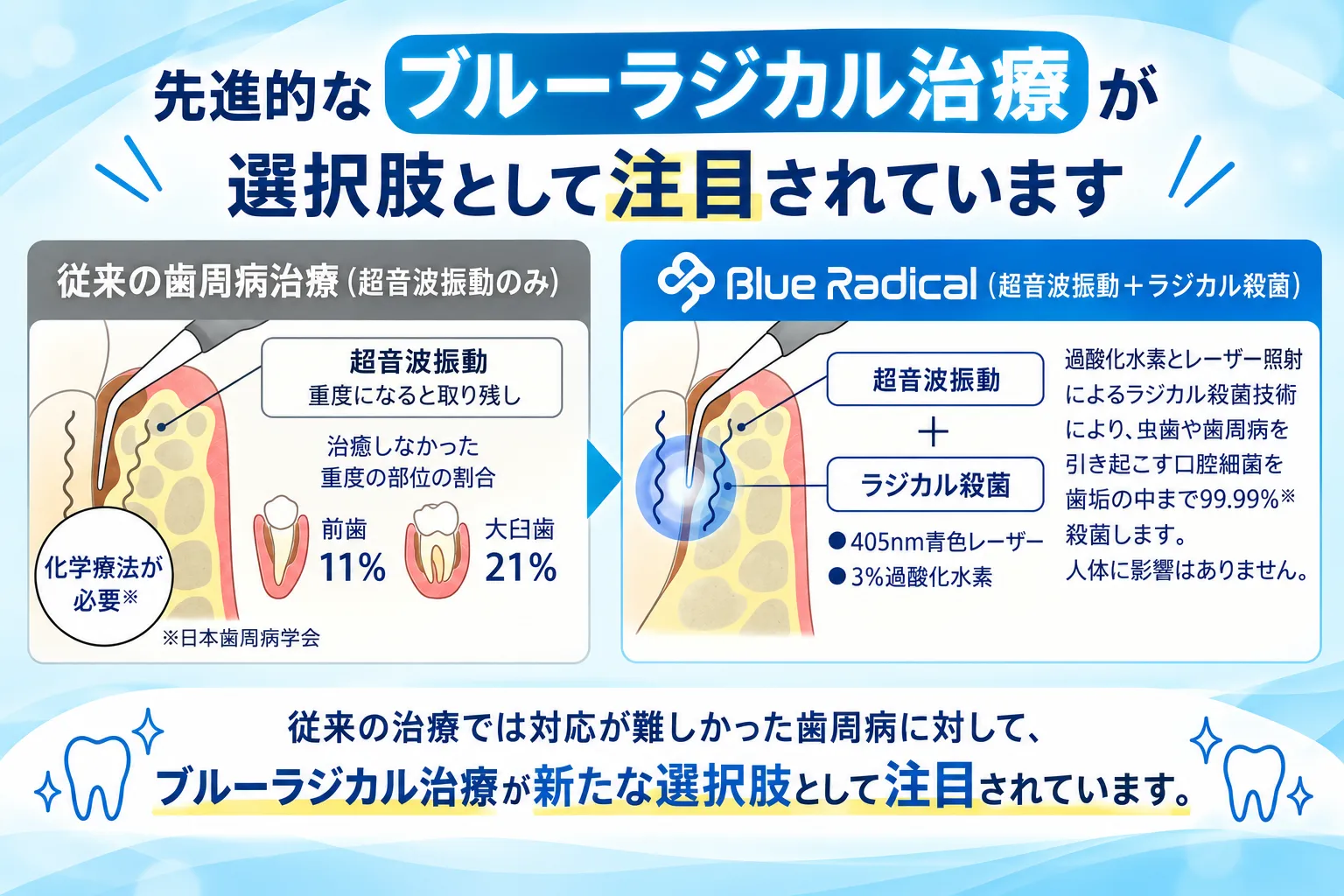 歯周病を埼玉県さいたま市緑区でブルーラジカルと歯磨きで改善する方法と治療の流れ