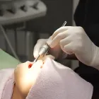 むし歯