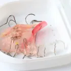 小児矯正